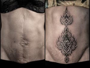 Lewis Ink – история перекрытия шрама татуировкой
